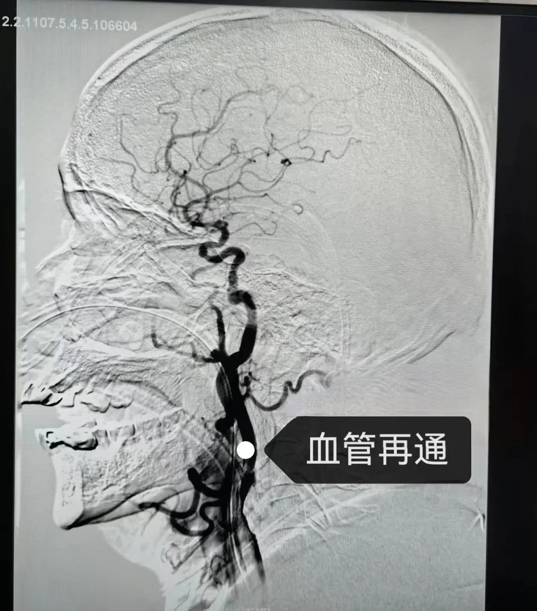 1729563313396051579.jpg auto